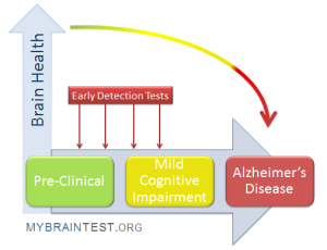 Alzheimer’s Early Detection: New At-Home Testing Method